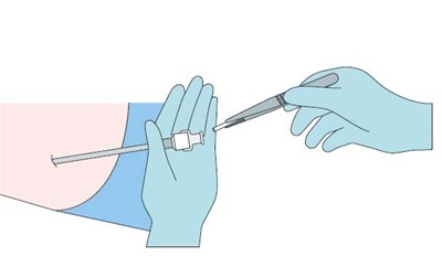 Step 5 (Step 5)
